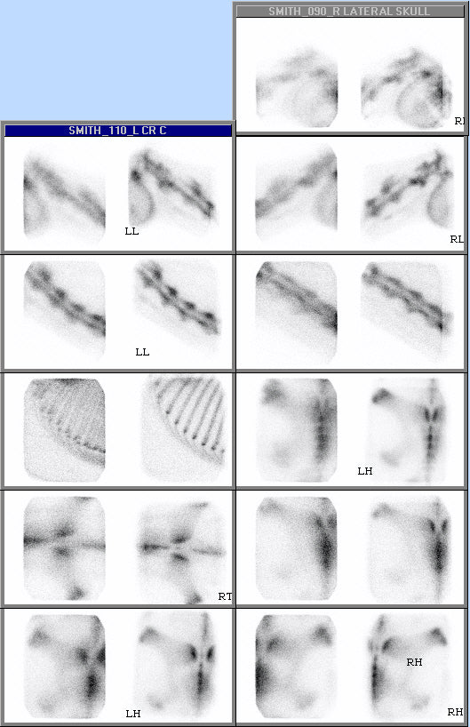Veterinary Scintigraphy System